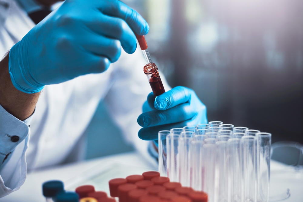 Lab technician in gloves using a pipette on a blood sample tube beside a rack of empty test tubes